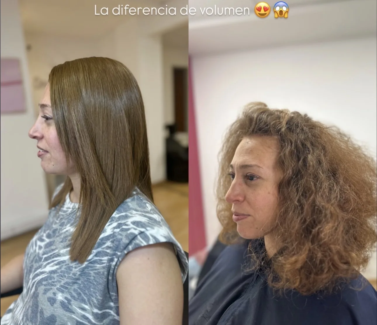 Antes y después con reducción de volumen